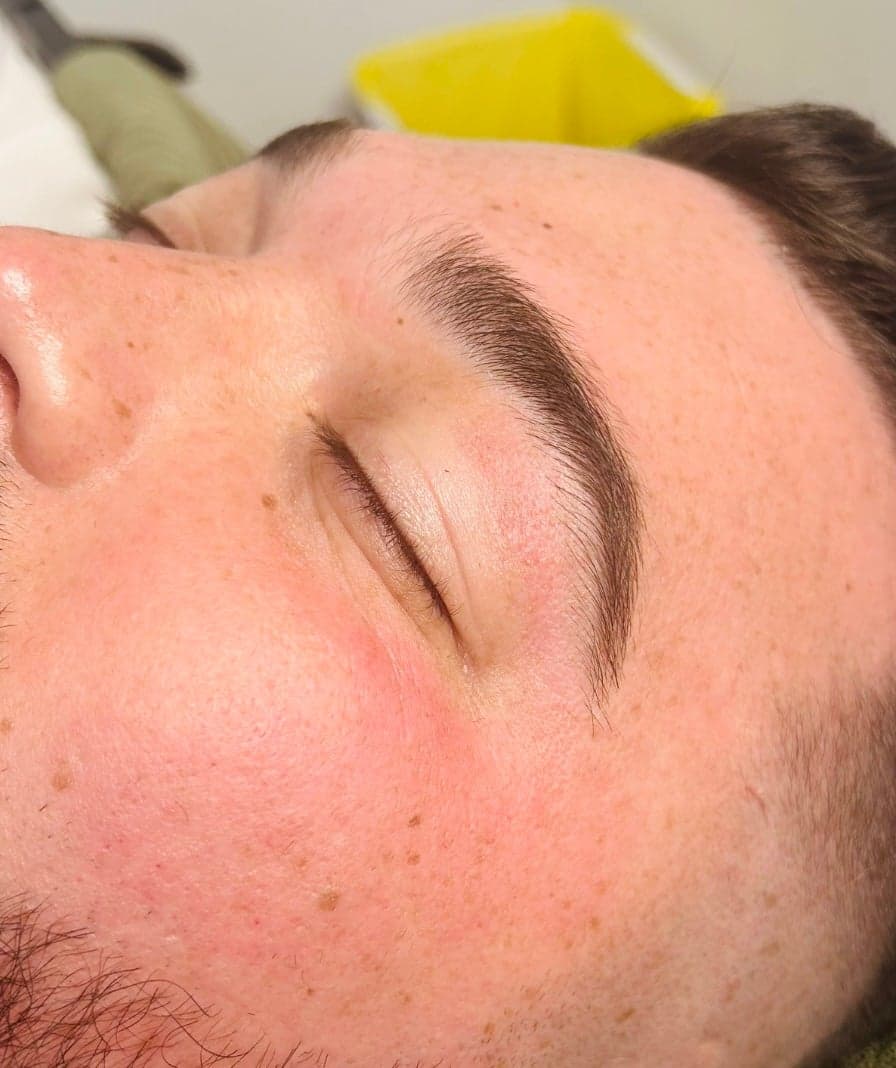 Facial waxing